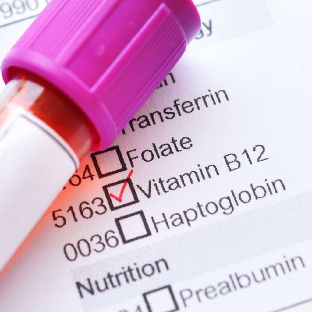 b12-supplement