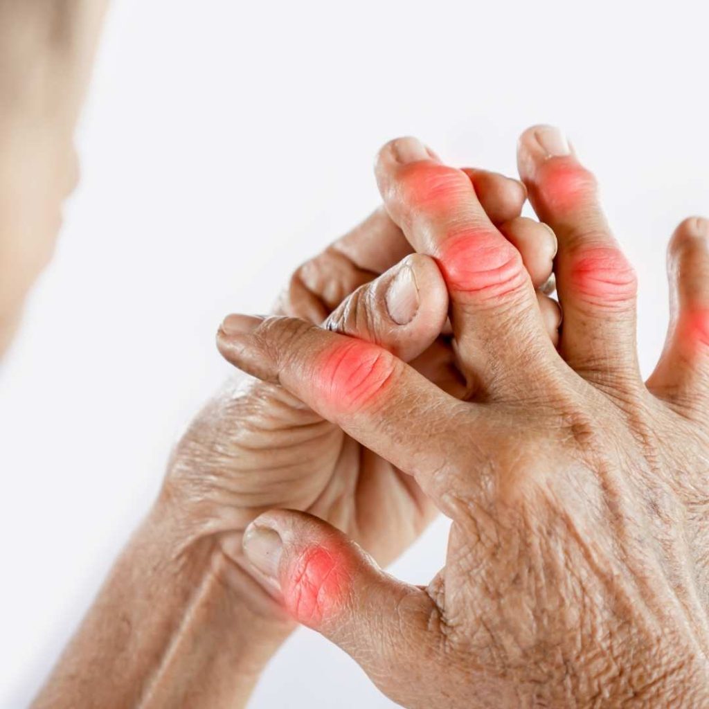 gout-plant-based-diet